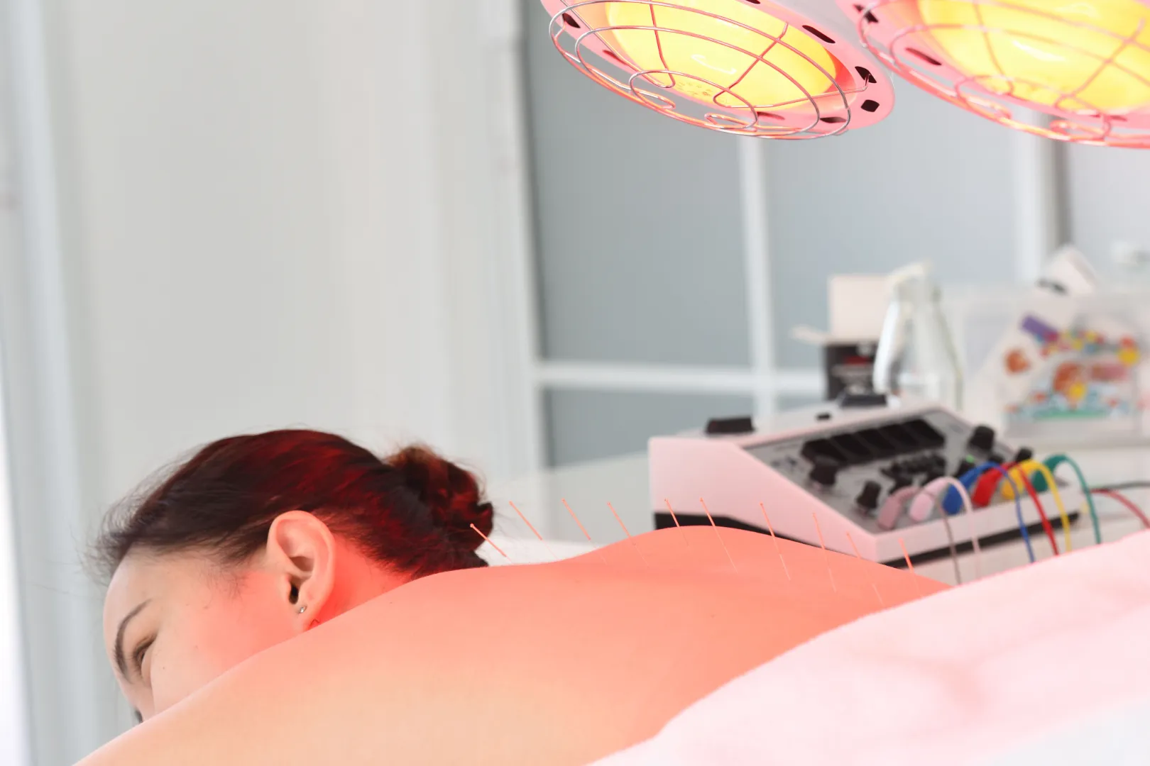 Acupuncture treatment